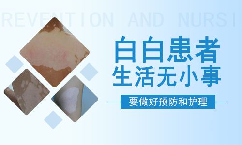 白癜風的正確護理方法有什么