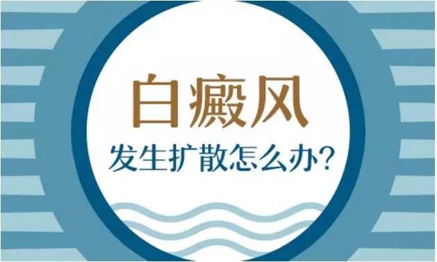 白癜風(fēng)繼續(xù)擴散怎么辦
