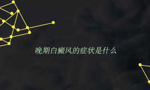 晚期白癜風的癥狀是什么